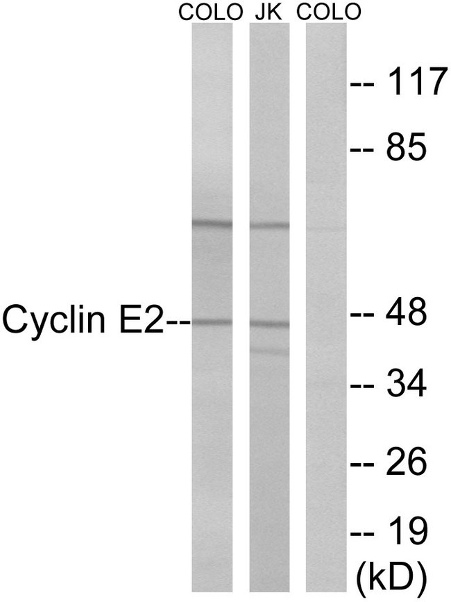 CCNE2 / Cyclin E2 Antibody - Western blot analysis of lysates from COLO and Jurkat cells, using Cyclin E2 Antibody. The lane on the right is blocked with the synthesized peptide.