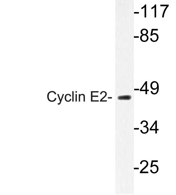 CCNE2 / Cyclin E2 Antibody - Western blot of Cyclin E2 (N387) pAb in extracts from Jurkat cell'.