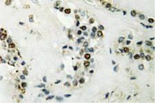 CCNE2 / Cyclin E2 Antibody - IHC of Cyclin E2 (N387) pAb in paraffin-embedded human thyroid gland tissue.