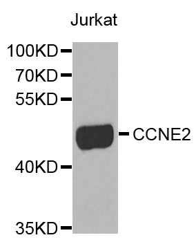 CCNE2 / Cyclin E2 Antibody - Western blot analysis of extracts of Jurkat cells.
