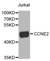 CCNE2 / Cyclin E2 Antibody - Western blot analysis of extracts of Jurkat cells.