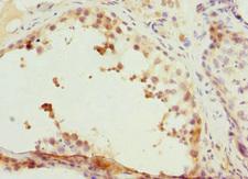 CCNE2 / Cyclin E2 Antibody - Immunohistochemistry of paraffin-embedded human testis tissue at dilution 1:100