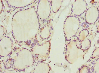 CCNE2 / Cyclin E2 Antibody - Immunohistochemistry of paraffin-embedded human thyroid tissue at dilution 1:100