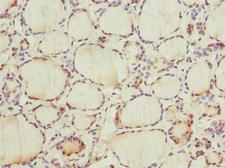 CCNE2 / Cyclin E2 Antibody - Immunohistochemistry of paraffin-embedded human thyroid tissue at dilution 1:100