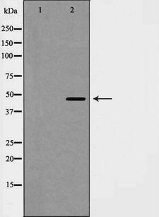 CCNE2 / Cyclin E2 Antibody - Western blot analysis of Cyclin E2 expression in COLO cells. The lane on the left is treated with the antigen-specific peptide.
