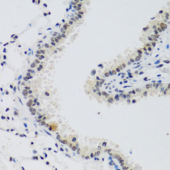 CCNE2 / Cyclin E2 Antibody - Immunohistochemistry of paraffin-embedded Mouse lung using CCNE2 Polyclonal Antibody at dilution of 1:100 (40x lens).
