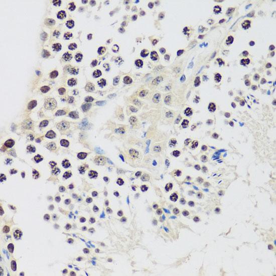 CCNE2 / Cyclin E2 Antibody - Immunohistochemistry of paraffin-embedded Mouse testis using CCNE2 Polyclonal Antibody at dilution of 1:100 (40x lens).