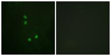 CCNE2 / Cyclin E2 Antibody - Immunofluorescence analysis of NIH/3T3 cells, using Cyclin E2 (Phospho-Thr392) Antibody. The picture on the right is blocked with the phospho peptide.