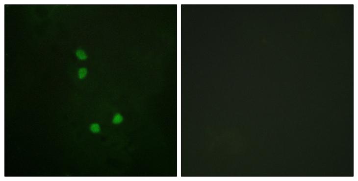 CCNE2 / Cyclin E2 Antibody - P-peptide - + Immunofluorescence analysis of NIH/3T3 cells, using Cyclin E2 (Phospho-Thr392) antibody. Cyclin E2 (Phospho-Thr392) antibody reacts with epitope-specific phosphopeptide and corresponding non-phosphopeptide.