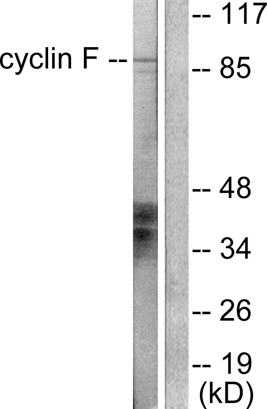 CCNF / Cyclin F Antibody - Western blot analysis of lysates from HeLa cells, using Cyclin F Antibody. The lane on the right is blocked with the synthesized peptide.