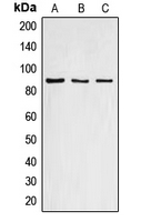 CCNF / Cyclin F Antibody - Western blot analysis of Cyclin F expression in HEK293T (A); mouse liver (B); rat liver (C) whole cell lysates.