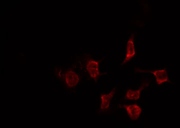CCNF / Cyclin F Antibody - Staining HeLa cells by IF/ICC. The samples were fixed with PFA and permeabilized in 0.1% Triton X-100, then blocked in 10% serum for 45 min at 25°C. The primary antibody was diluted at 1:200 and incubated with the sample for 1 hour at 37°C. An Alexa Fluor 594 conjugated goat anti-rabbit IgG (H+L) Ab, diluted at 1/600, was used as the secondary antibody.