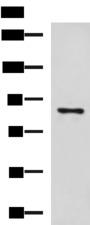 CCNF / Cyclin F Antibody - Western blot analysis of 293T cell lysate  using CCNF Polyclonal Antibody at dilution of 1:800