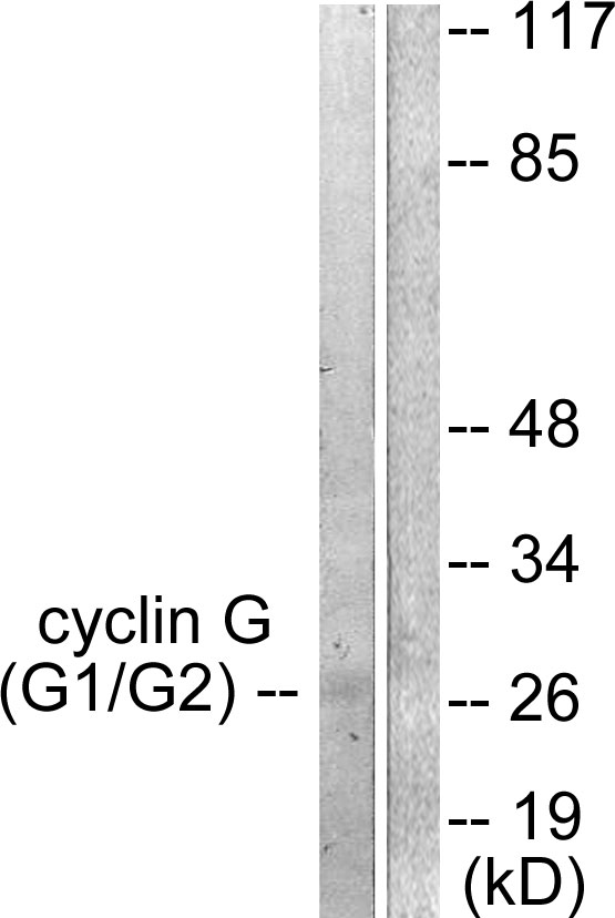 CCNG1 / Cyclin G1 Antibody - Western blot analysis of lysates from Jurkat cells, using Cyclin G Antibody. The lane on the right is blocked with the synthesized peptide.