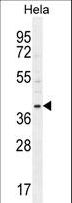 CCNG1 / Cyclin G1 Antibody - CCNG1 Antibody western blot of HeLa cell line lysates (35 ug/lane). The CCNG1 antibody detected the CCNG1 protein (arrow).