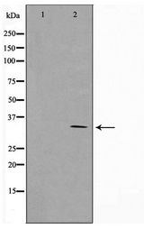 CCNG1 / Cyclin G1 Antibody - Western blot of Jurkat cell lysate using Cyclin G Antibody