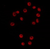 CCNG1 / Cyclin G1 Antibody - Staining HeLa cells by IF/ICC. The samples were fixed with PFA and permeabilized in 0.1% Triton X-100, then blocked in 10% serum for 45 min at 25°C. The primary antibody was diluted at 1:200 and incubated with the sample for 1 hour at 37°C. An Alexa Fluor 594 conjugated goat anti-rabbit IgG (H+L) Ab, diluted at 1/600, was used as the secondary antibody.
