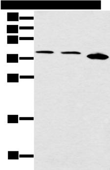 CCNG1 / Cyclin G1 Antibody - Western blot analysis of Jurkat Hela and 231 cell  using CCNG1 Polyclonal Antibody at dilution of 1:400