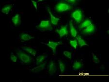 CCNG2 / Cyclin G2 Antibody - Immunofluorescence of monoclonal antibody to CCNG2 on HeLa cell. [antibody concentration 10 ug/ml]