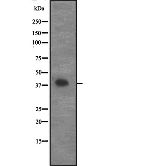 CCNG2 / Cyclin G2 Antibody - Western blot analysis of CCNG2 expression in 293 cells line lysates. The lane on the left is treated with the antigen-specific peptide.