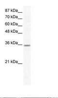 CCNG2 / Cyclin G2 Antibody - Jurkat Cell Lysate.  This image was taken for the unconjugated form of this product. Other forms have not been tested.
