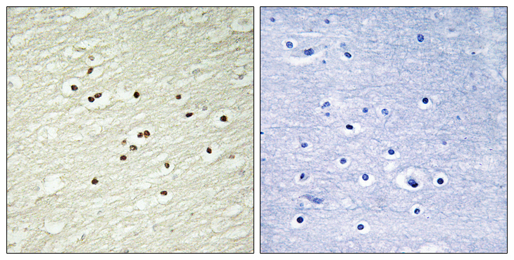 CCNH / Cyclin H Antibody - Immunohistochemistry analysis of paraffin-embedded human brain tissue, using Cyclin H Antibody. The picture on the right is blocked with the synthesized peptide.
