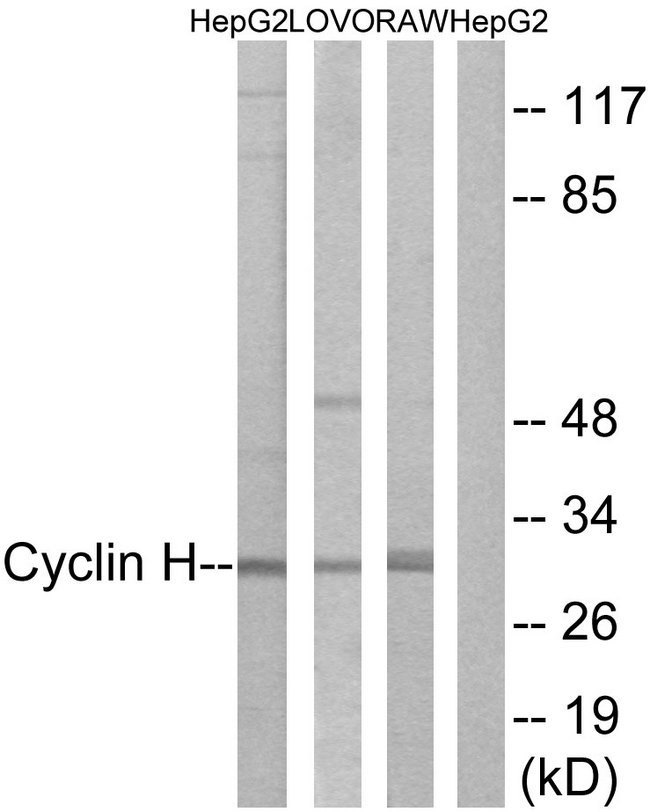 CCNH / Cyclin H Antibody - Western blot analysis of lysates from HepG2, LOVO, and RAW264.7 cells, using Cyclin H Antibody. The lane on the right is blocked with the synthesized peptide.