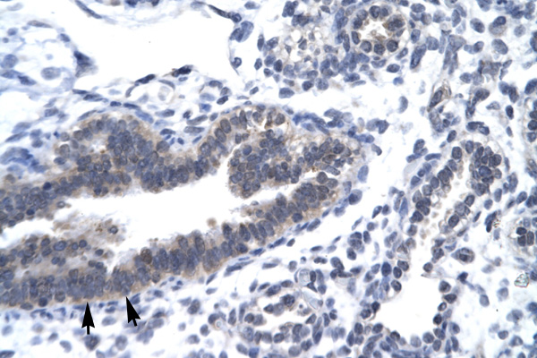 CCNH / Cyclin H Antibody - CCNH / Cyclin H antibody AVARP03026_T100-NP_001230-CCNH (cyclin H) Antibody IHC of formalin-fixed, paraffin-embedded human Lung. Positive label: Epithelial cells of bronchiole indicated with arrows. Antibody concentration 4-8 ug/ml. Magnification 400X.  This image was taken for the unconjugated form of this product. Other forms have not been tested.