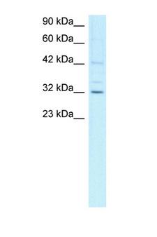 CCNH / Cyclin H Antibody - CCNH / Cyclin H antibody AVARP03026_T100-NP_001230-CCNH (cyclin H) Antibody Western blot of Jurkat Cell lysate. Antibody concentration 1 ug/ml.  This image was taken for the unconjugated form of this product. Other forms have not been tested.