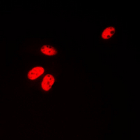 CCNH / Cyclin H Antibody - Immunofluorescent analysis of Cyclin H staining in HeLa cells. Formalin-fixed cells were permeabilized with 0.1% Triton X-100 in TBS for 5-10 minutes and blocked with 3% BSA-PBS for 30 minutes at room temperature. Cells were probed with the primary antibody in 3% BSA-PBS and incubated overnight at 4 ??C in a humidified chamber. Cells were washed with PBST and incubated with a DyLight 594-conjugated secondary antibody (red) in PBS at room temperature in the dark. DAPI was used to stain the cell nuclei (blue).