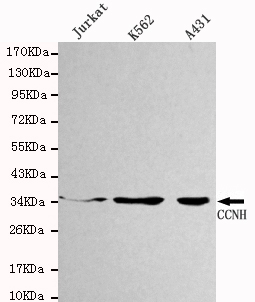 CCNH / Cyclin H Antibody - Western blot detection of CCNH in Jurkat,K562&A431 cell lysates using CCNH antibody (1:1000 diluted).