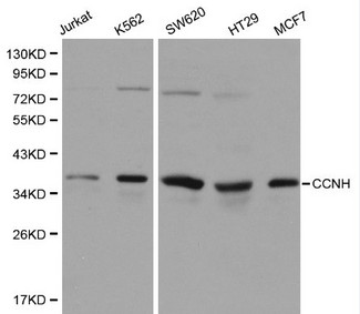 CCNH / Cyclin H Antibody - Western blot of CCNH pAb in extracts from Jurkat, K562, SW620, HT29 and MCF7 cells.