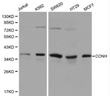 CCNH / Cyclin H Antibody - Western blot of CCNH pAb in extracts from Jurkat, K562, SW620, HT29 and MCF7 cells.