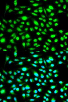CCNH / Cyclin H Antibody - Immunofluorescence analysis of HeLa cells.