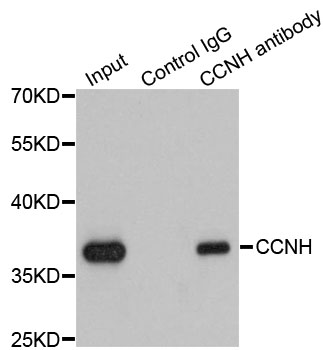 CCNH / Cyclin H Antibody - Immunoprecipitation analysis of 200ug extracts of K562 cells using 1ug CCNH antibody. Western blot was performed from the immunoprecipitate using CCNH antibodyat a dilition of 1:1000.