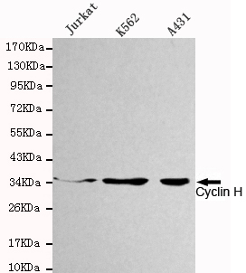 CCNH / Cyclin H Antibody - Western blot detection of Cyclin H in Jurkat, K562 and A431 cell lysates using Cyclin H mouse monoclonal antibody (1:1000 dilution). Predicted band size: 38KDa. Observed band size: 38KDa.