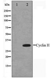 CCNH / Cyclin H Antibody - Western blot of HeLa cell lysate using Cyclin H Antibody