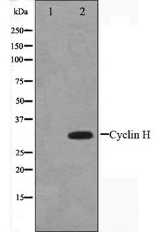 CCNH / Cyclin H Antibody - Western blot analysis on HeLa cell lysates using Cyclin H antibody. The lane on the left is treated with the antigen-specific peptide.