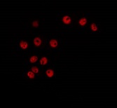 CCNH / Cyclin H Antibody - Staining HeLa cells by IF/ICC. The samples were fixed with PFA and permeabilized in 0.1% Triton X-100, then blocked in 10% serum for 45 min at 25°C. The primary antibody was diluted at 1:200 and incubated with the sample for 1 hour at 37°C. An Alexa Fluor 594 conjugated goat anti-rabbit IgG (H+L) Ab, diluted at 1/600, was used as the secondary antibody.