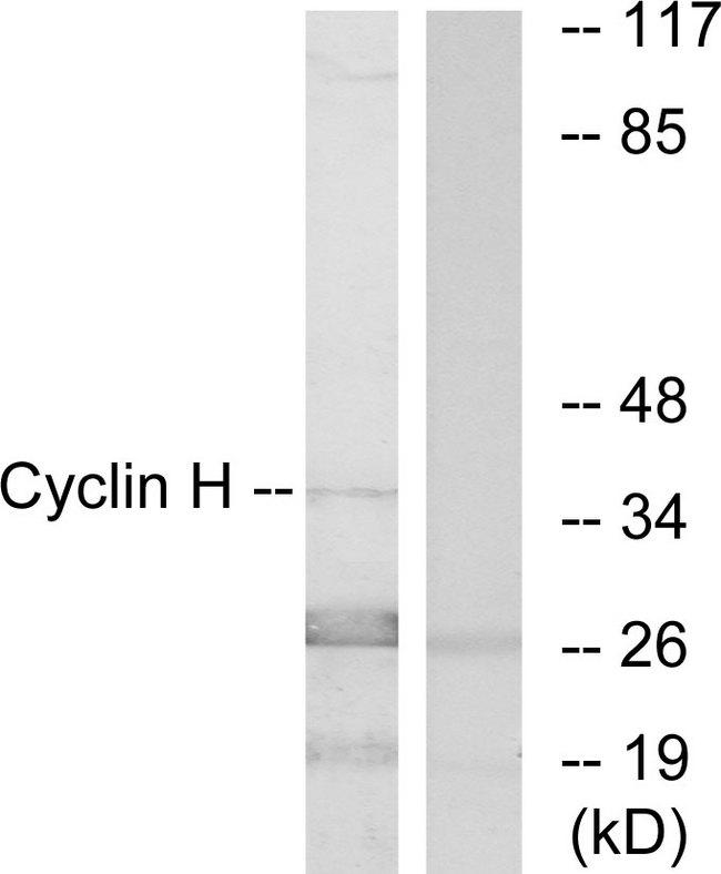 CCNH / Cyclin H Antibody - Western blot analysis of extracts from K562 cells, using Cyclin H (Ab-315) antibody.