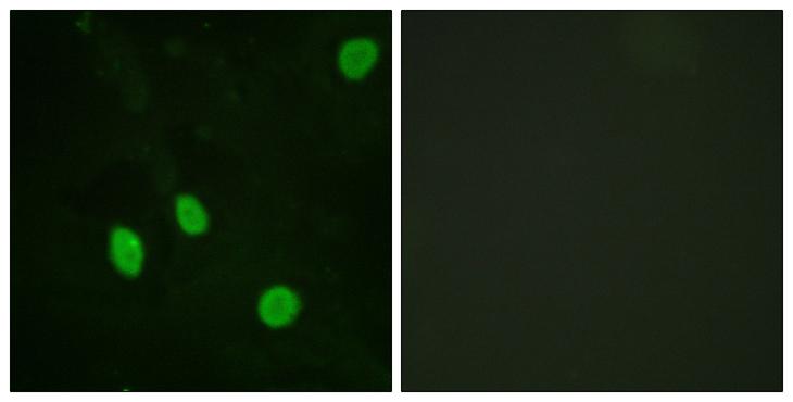 CCNH / Cyclin H Antibody - Peptide - + Immunofluorescence analysis of HeLa cells, using Cyclin H (Ab-315) antibody.
