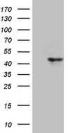 CCNI / Cyclin I Antibody - HEK293T cells were transfected with the pCMV6-ENTRY control. (Left lane) or pCMV6-ENTRY CCNI. (Right lane) cDNA for 48 hrs and lysed. Equivalent amounts of cell lysates. (5 ug per lane) were separated by SDS-PAGE and immunoblotted with anti-CCNI. (1:500)
