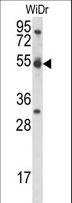 CCNI / Cyclin I Antibody - CCNI Antibody western blot of WiDr cell line lysates (35 ug/lane). The CCNI antibody detected the CCNI protein (arrow).