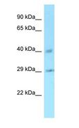 CCNJ Antibody - CCNJ antibody Western Blot of Rat Liver.  This image was taken for the unconjugated form of this product. Other forms have not been tested.