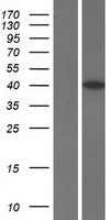 CCNJ Protein - Western validation with an anti-DDK antibody * L: Control HEK293 lysate R: Over-expression lysate