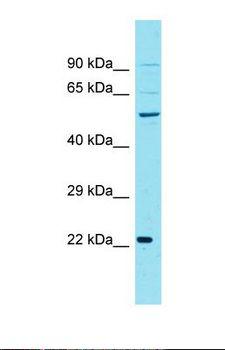 CCNJL Antibody - Western blot of Human PANC1. CCNJL antibody dilution 1.0 ug/ml.  This image was taken for the unconjugated form of this product. Other forms have not been tested.