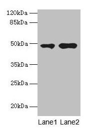 CCNJL Antibody - Western blot All lanes: CCNJL antibody at 3µg/ml Lane 1: U251 whole cell lysate Lane 2: Mouse liver tissue Secondary Goat polyclonal to rabbit IgG at 1/10000 dilution Predicted band size: 49, 19 kDa Observed band size: 49 kDa