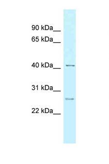 CCNK Antibody - CCNK antibody Western blot of 8226 Cell lysate. Antibody concentration 1 ug/ml.  This image was taken for the unconjugated form of this product. Other forms have not been tested.