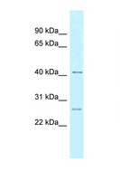 CCNK Antibody - CCNK antibody Western blot of 8226 Cell lysate. Antibody concentration 1 ug/ml.  This image was taken for the unconjugated form of this product. Other forms have not been tested.