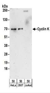 CCNK Antibody - Detection of Human Cyclin K by Western Blot. Samples: Whole cell lysate (50 ug) from HeLa, 293T, and Jurkat cells. Antibodies: Affinity purified rabbit anti-Cyclin K antibody used for WB at 0.1 ug/ml. Detection: Chemiluminescence with an exposure time of 3 minutes.